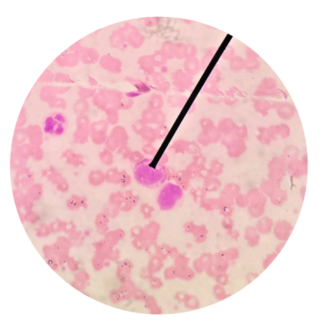 <p>what kind of white blood cells is this?</p>