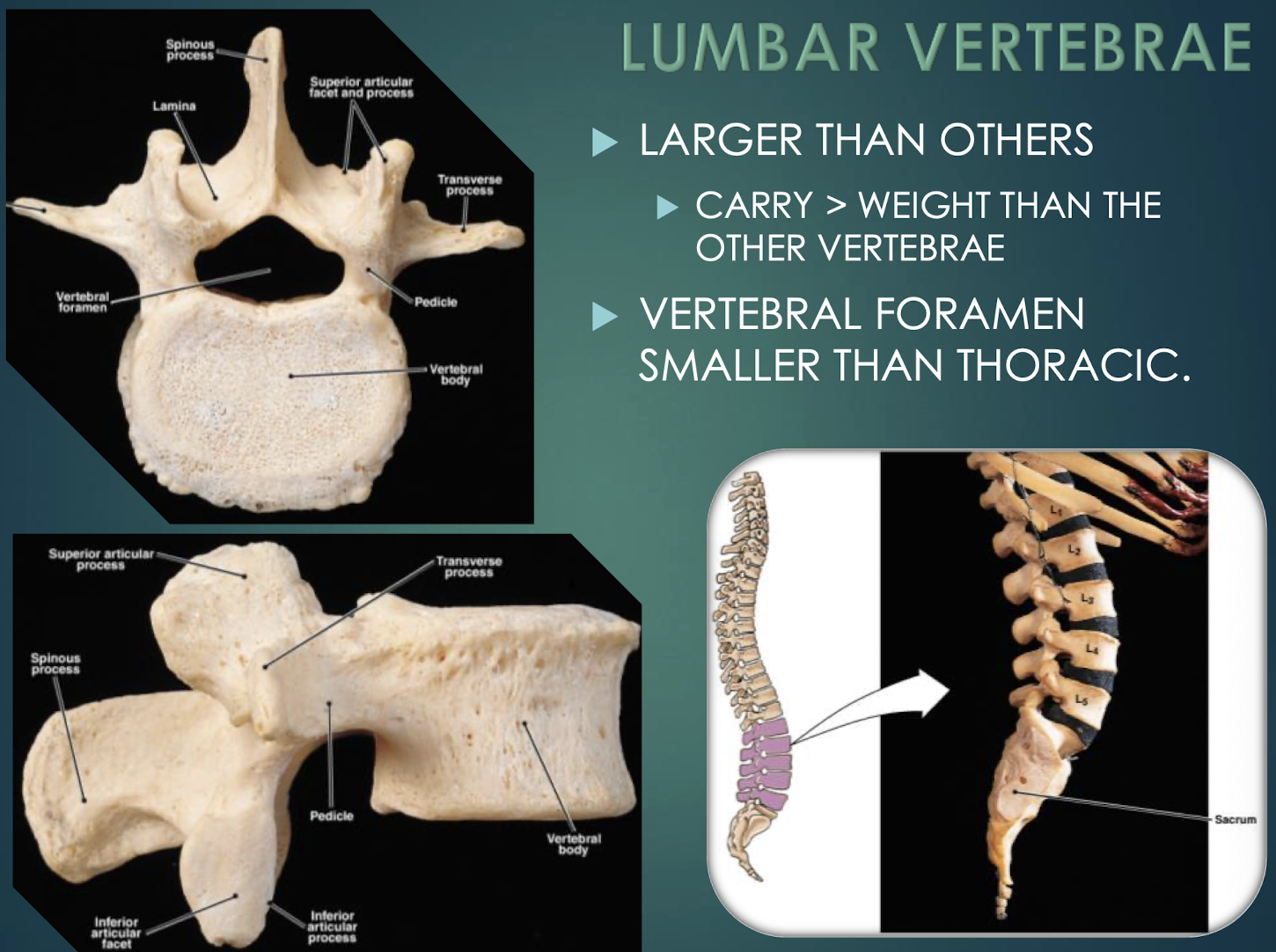 <p>Lumbar Vertebrae</p>