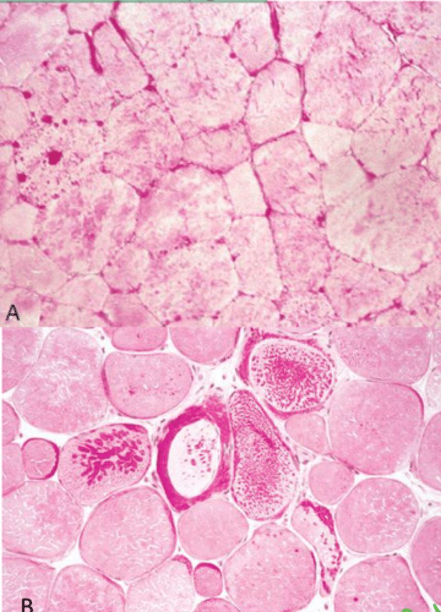 <p>Identify the pathology?</p>