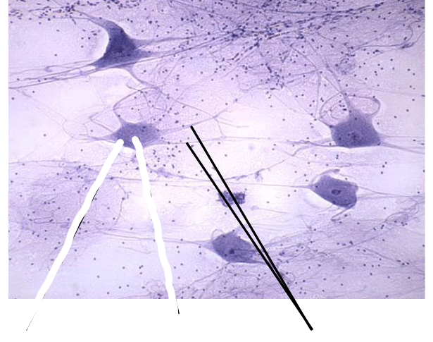 <p>Cytoplasmic Extensions</p>