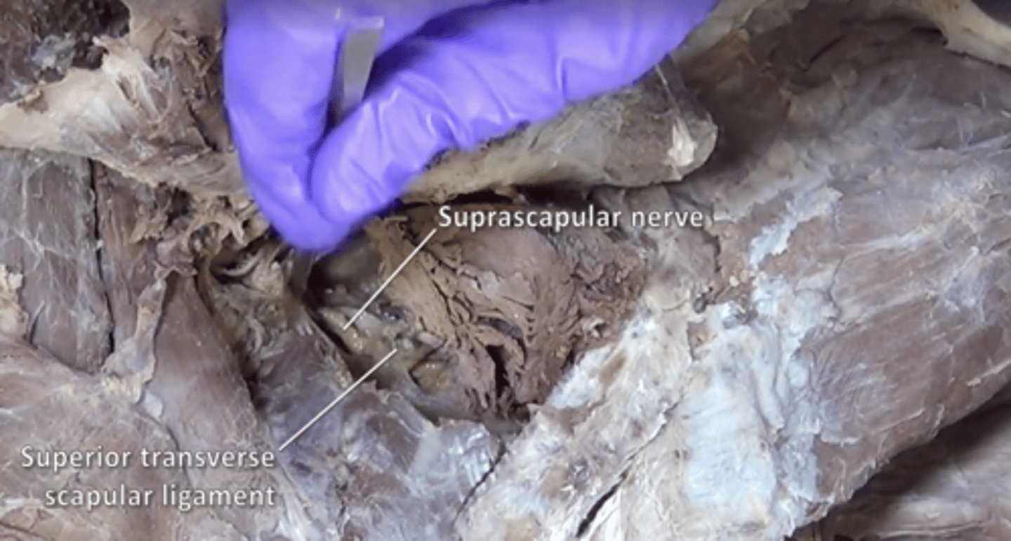 <p>supraspinatus and infraspinatus</p>