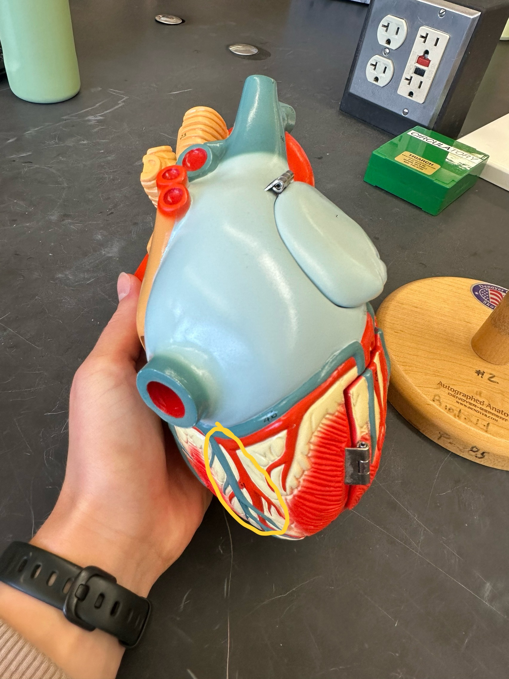 <p>Right marginal artery </p>