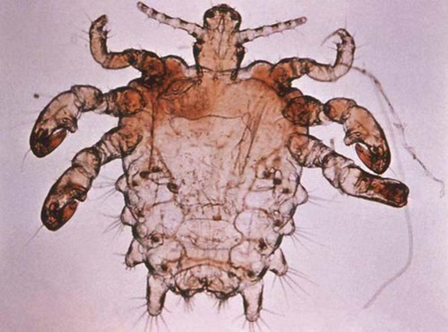 <p>6 legs</p>