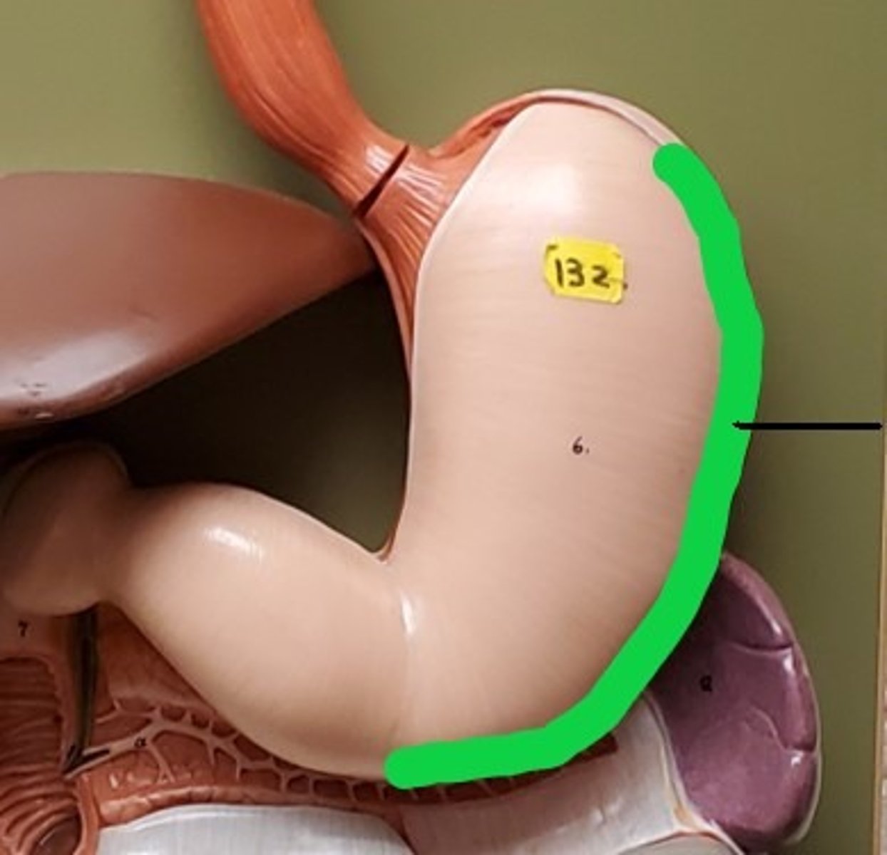 <p>ID the Convex Border of the Stomach</p>