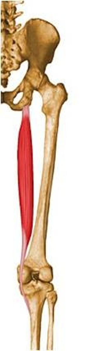 <p>Ischial tuberosity</p>