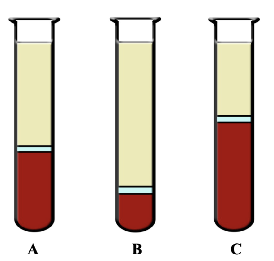<p>What is B?</p>