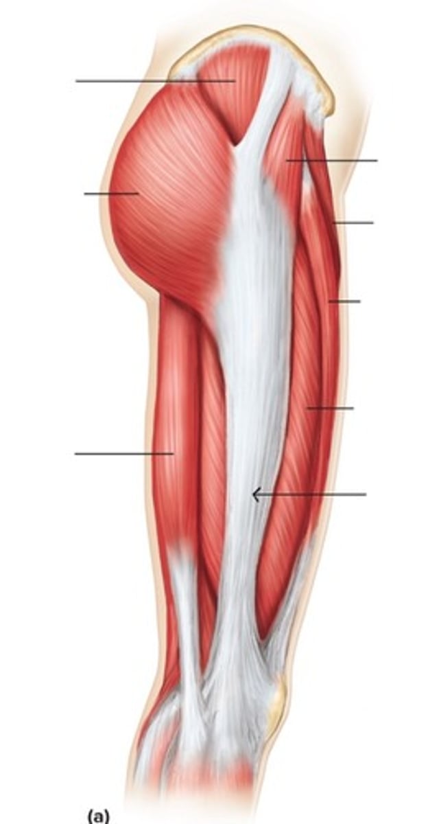 <p>What tendon is this?</p>