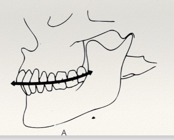 <p>Anatomic curvature of the occlusal alignment of teeth, at tip of lower canine, following buccal cusps of premolars and molars until anterior border of ramus.</p><p><span style="font-size: calc(var(--scale-factor)*19.00px);"><span>❖ </span></span><span style="font-size: calc(var(--scale-factor)*32.00px);"><span>Establishes </span></span><span style="font-size: calc(var(--scale-factor)*36.00px);"><span>a correct sagital and vertical relationship</span></span><br><span style="font-size: calc(var(--scale-factor)*36.00px);"><span>between the maxilla and the mandible.</span></span><br><span style="font-size: calc(var(--scale-factor)*22.00px);"><span>❖ </span></span><span style="font-size: calc(var(--scale-factor)*36.00px);"><span>Therefore, it is strongly related with a proper</span></span><br><span style="font-size: calc(var(--scale-factor)*19.00px);"><span>❖ </span></span><span style="font-size: calc(var(--scale-factor)*32.00px);"><span>overbite</span></span><br><span style="font-size: calc(var(--scale-factor)*19.00px);"><span>❖ </span></span><span style="font-size: calc(var(--scale-factor)*32.00px);"><span>Overjet</span></span><br><span style="font-size: calc(var(--scale-factor)*19.00px);"><span>❖ </span></span><span style="font-size: calc(var(--scale-factor)*32.00px);"><span>Lower third of the face</span></span></p>