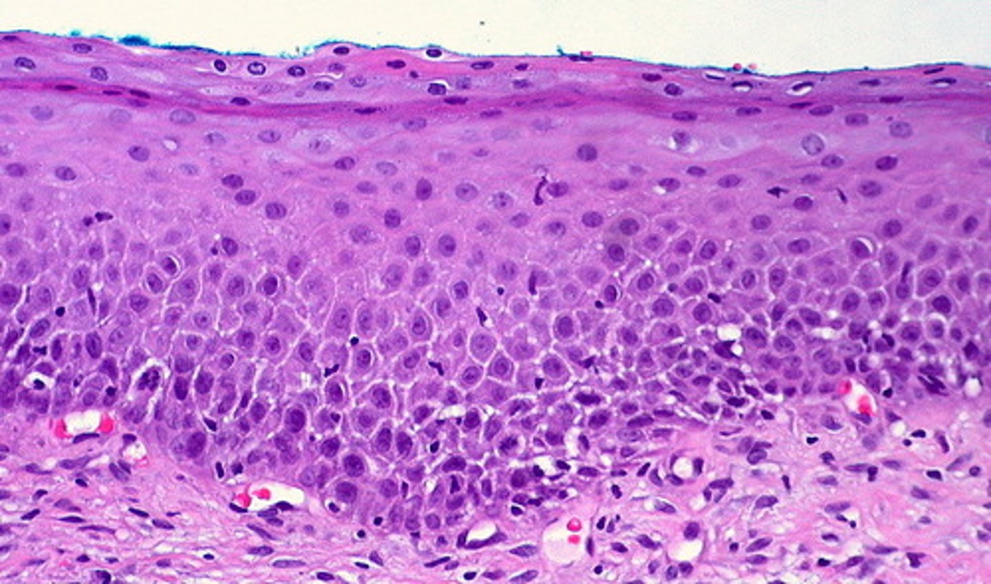<p>What type of tissue is this?</p>