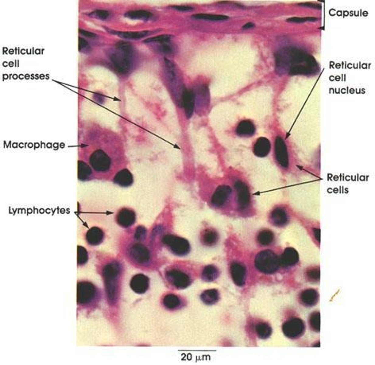 <p>A type of fibroblast found in lymph nodes and bone marrow that synthesize reticular fibers and may have phagocytic function.</p>