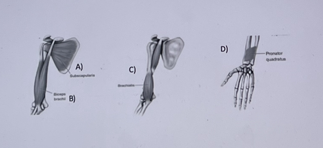 Which of the following is an example of a biarticular muscle? 