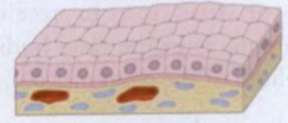 <p>Simple cubiodal (enlaget kubisk); mere cirkulære kerner da der plads</p>