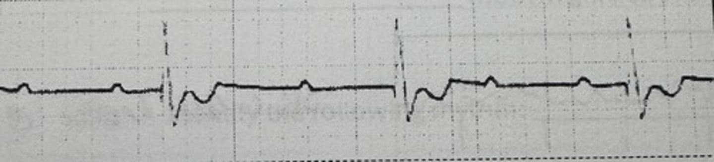 <p>identify the rhythm</p>