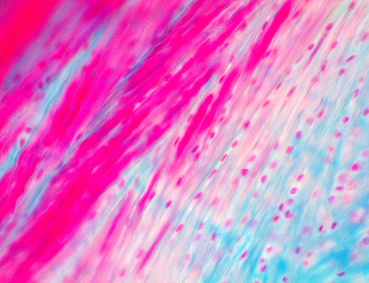<p><span>Found in the menisci of the knee, intervertebral discs of the spine, and the pubic symphysis</span></p>