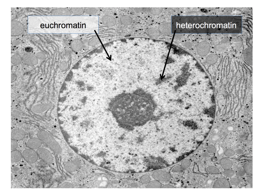 <ol><li><p>densely packed heterochromatin</p><ul><li><p>(no active genes)</p></li></ul></li><li><p>(relatively) decondensed euchromatin</p><ul><li><p>(active genes present)</p></li></ul></li></ol><p></p>