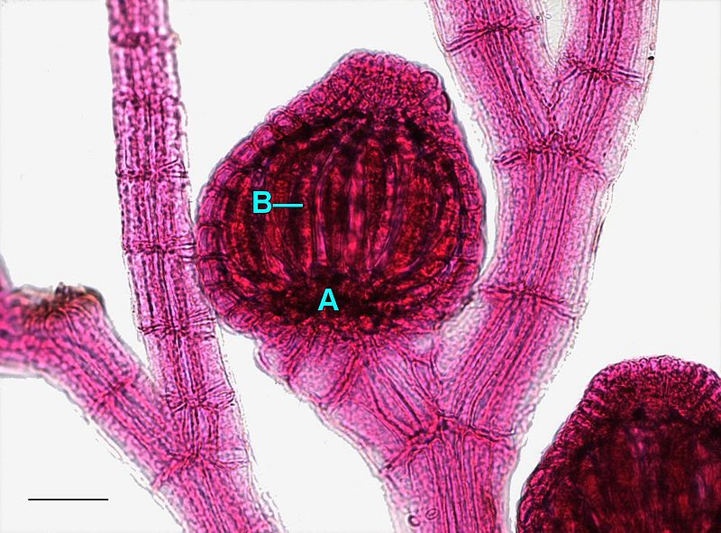 <p>Polysiphonia: Vad visar bilden?</p>