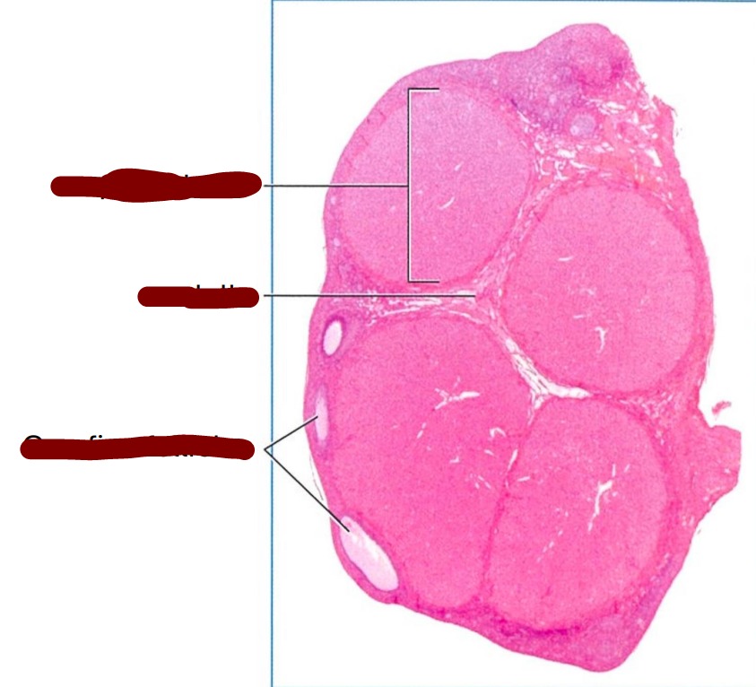 <p>section through an adult cat ovary with corpus luteum </p>