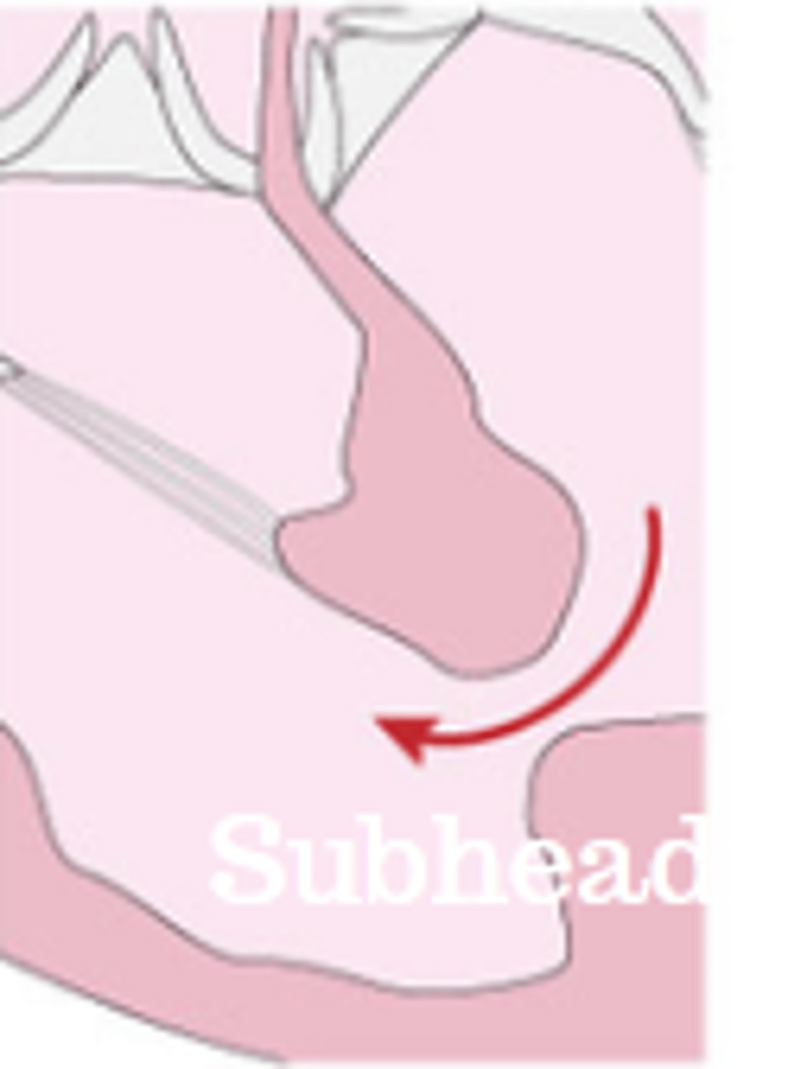 <p>found at the lower part of the septum in the muscle layer. Small muscular VSDs have a high chance of closing on their own.</p>