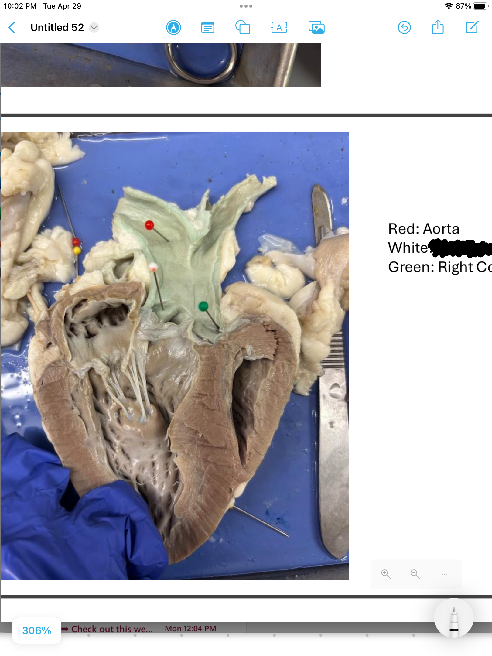 <p>label the area</p>