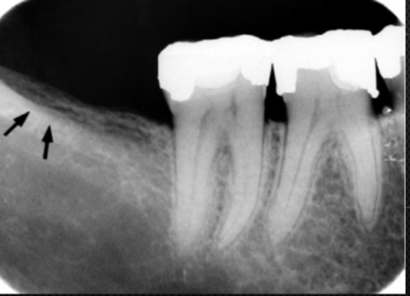 <p>Identify the structure</p>