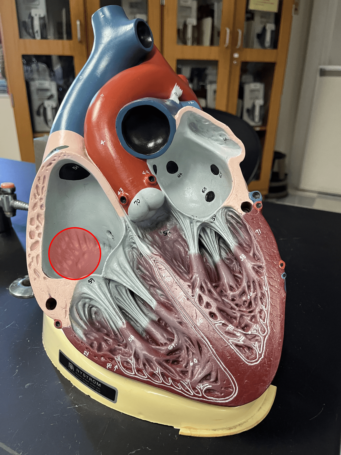• Parallel arrangement of cardiac muscle bundles appearing as ridges.

• Located on the anterior side of the interior wall of the right atrium.
