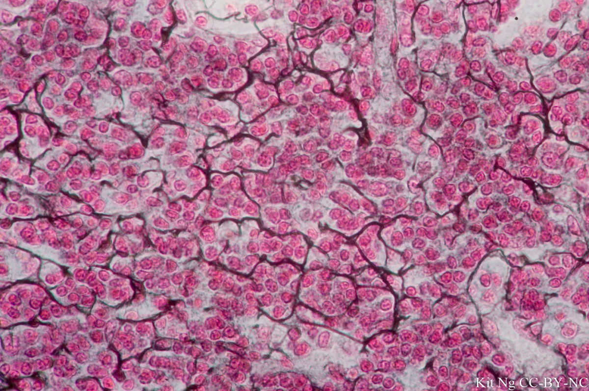 <p>what kind of tissue is this (subtype and type)</p>