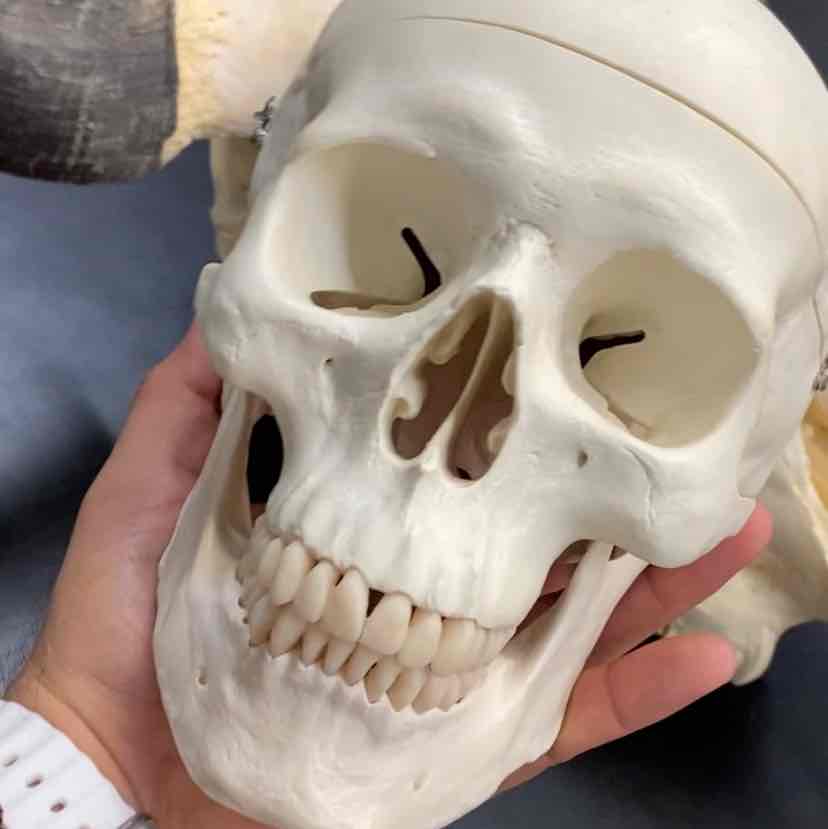 <ul><li><p>Order- primates</p></li><li><p>fam- Hominidae </p></li></ul><p>large braincase. most with prominent face and prognathus jaw. nostrils close together and facing forward and downward. tooth rows form rounded arches. upper molars quadrate and bunodont. lowers are bunodont and have a hypoconulid. omnivorous </p>