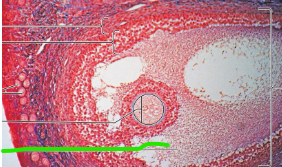 term image
