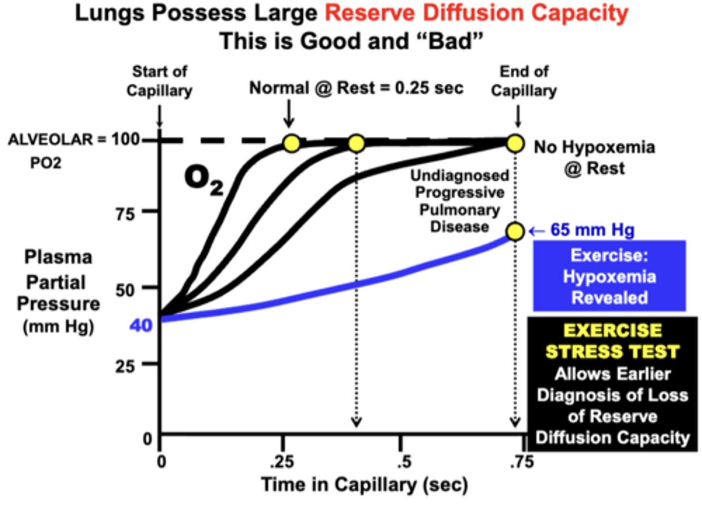 <p>a patient may possess a significant degree of pulmonary impairment, but have only mild or no symptoms at rest</p><p>Patient with Progressively Worsening Pulmonary Disease:</p><p>- at rest: is still able to fully re-saturate hemoglobin even though equilibration time is significantly increased over time (No Hypoxemia Evident @ Rest)</p><p>- during exercise: hypoxemia becomes evident (Hypoxemia Revealed During Exercise)</p><p>= Based on this effect, this is one reason why an Exercise Stress Test is administered diagnostically to patients suspected of developing a lung diffusion or other cardiopulmonary disorder: Earlier Diagnosis</p>