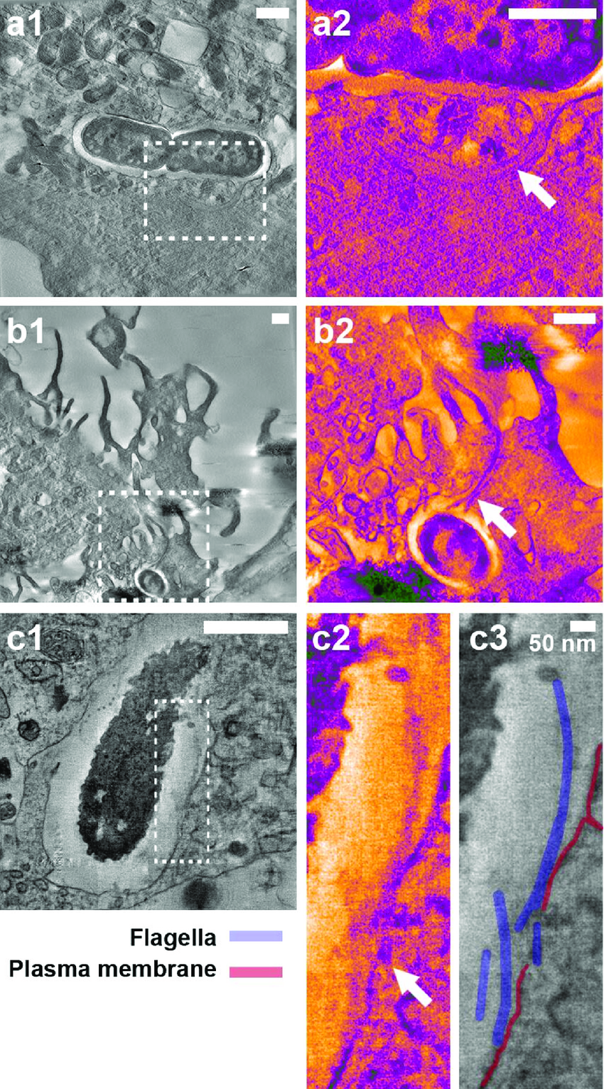 Electron tomography