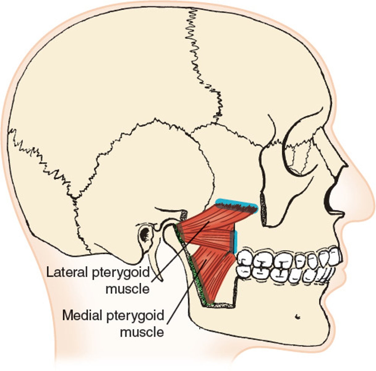 <p>origin: pterygoid plate insertion: mandible action: elevate and protract mandible, and lateral movement of opposite side of mandible</p><p>innervation: All trigeminal, V3</p>