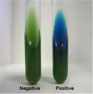 <p>What <strong>biochemical test</strong> detects the ability of the enteric organism to utilize the <strong>citrate </strong>as the carbon source?</p>