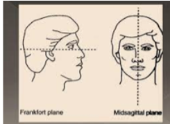 <p>wat are the exposure steps </p>