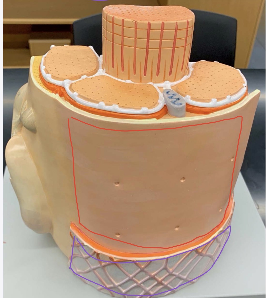 <p>What is the red surrounding?</p>