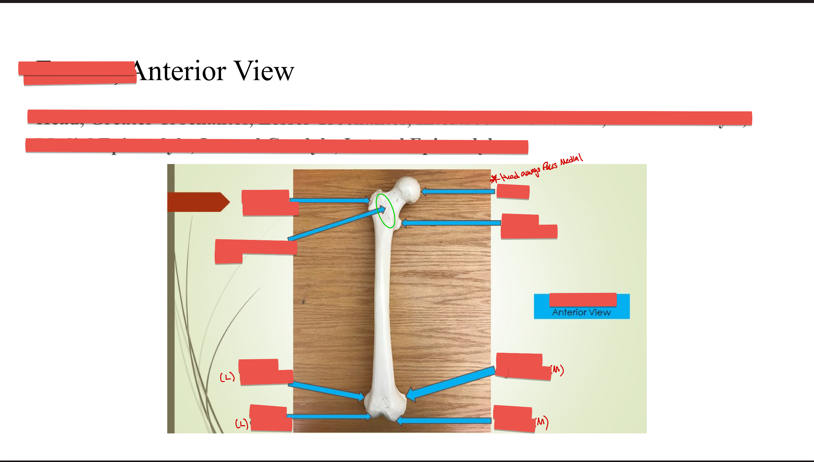 <p>Intertrochanteric line</p>