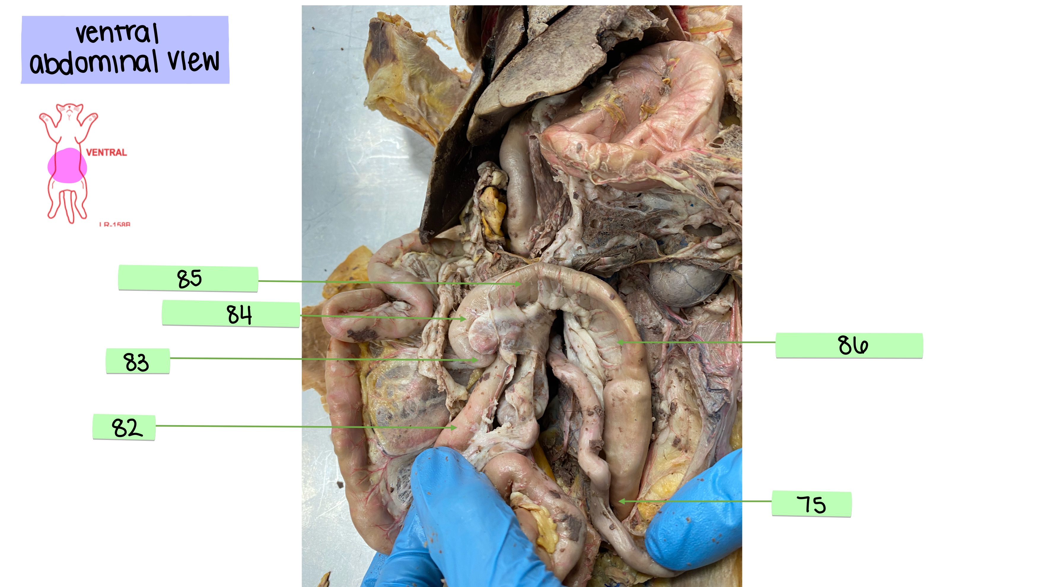 <p>ascending colon</p>