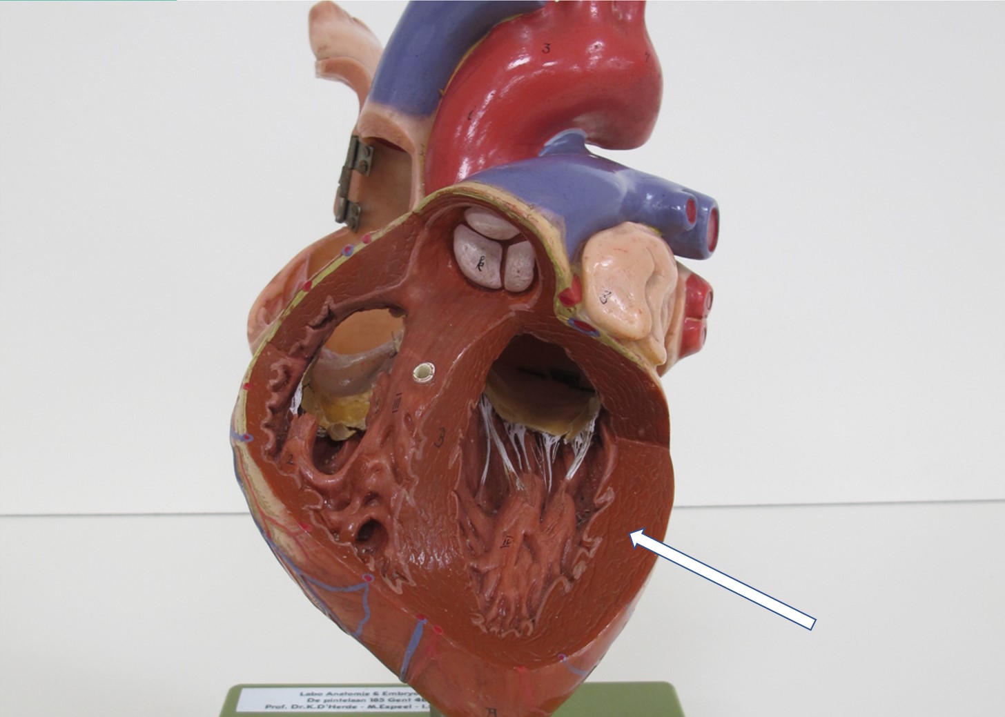 <p>deel van hartwand</p>