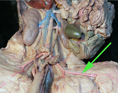 <p><span>the green arrow is showing us the .....?</span><strong>femoral artery</strong></p>