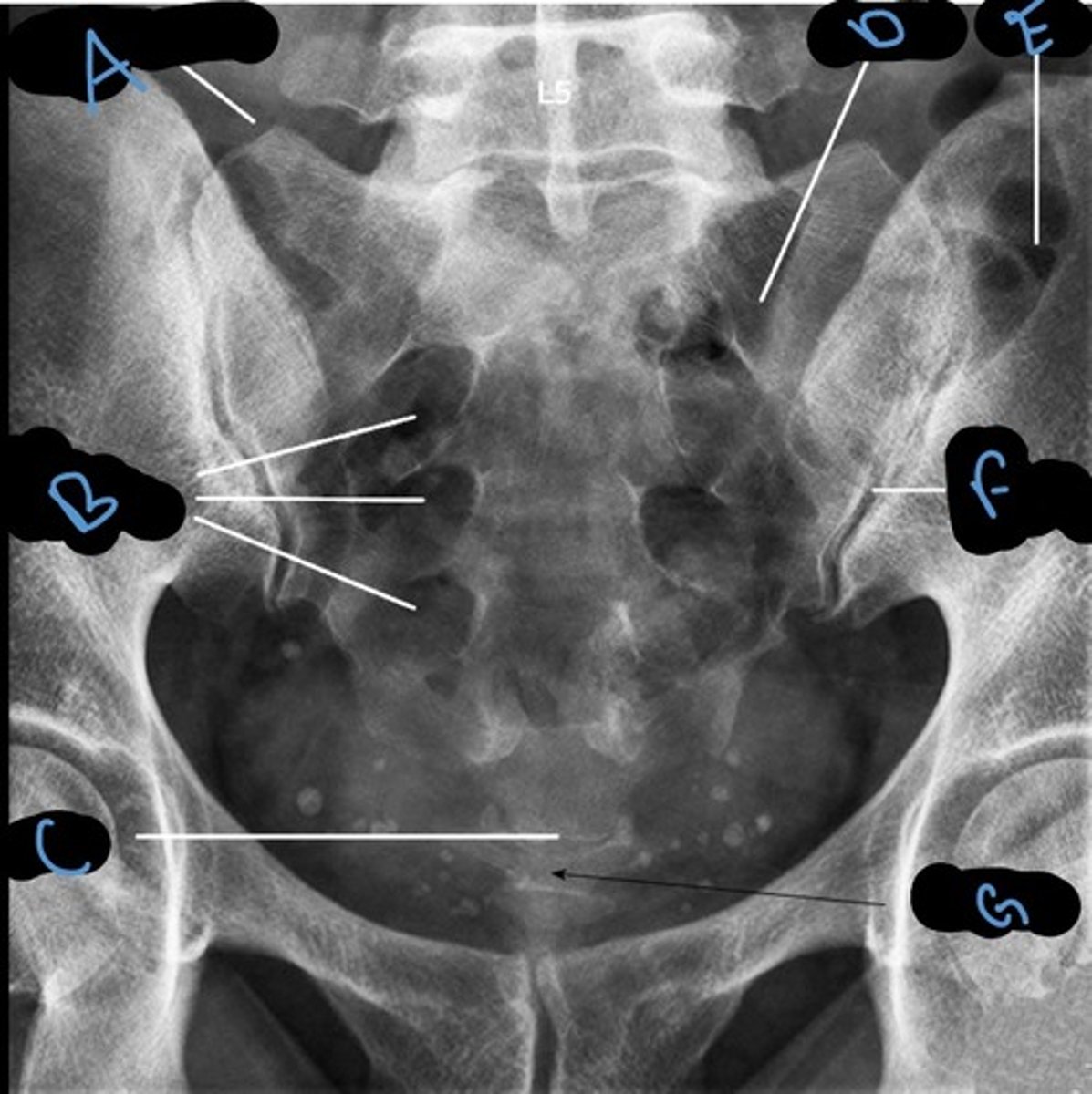 <p>Label the anatomy indicated by letter C:</p>