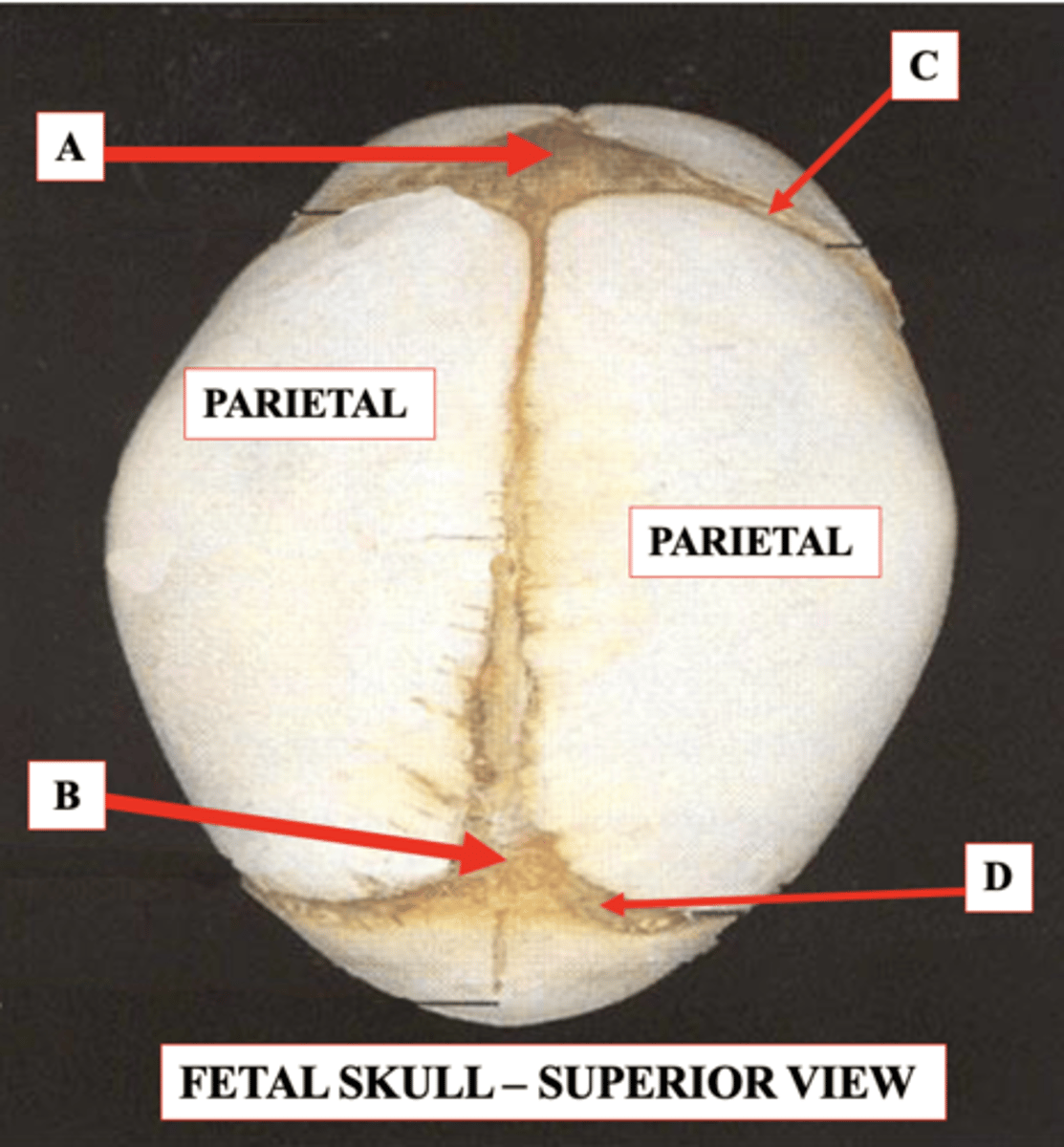 <p>Identify C.</p>
