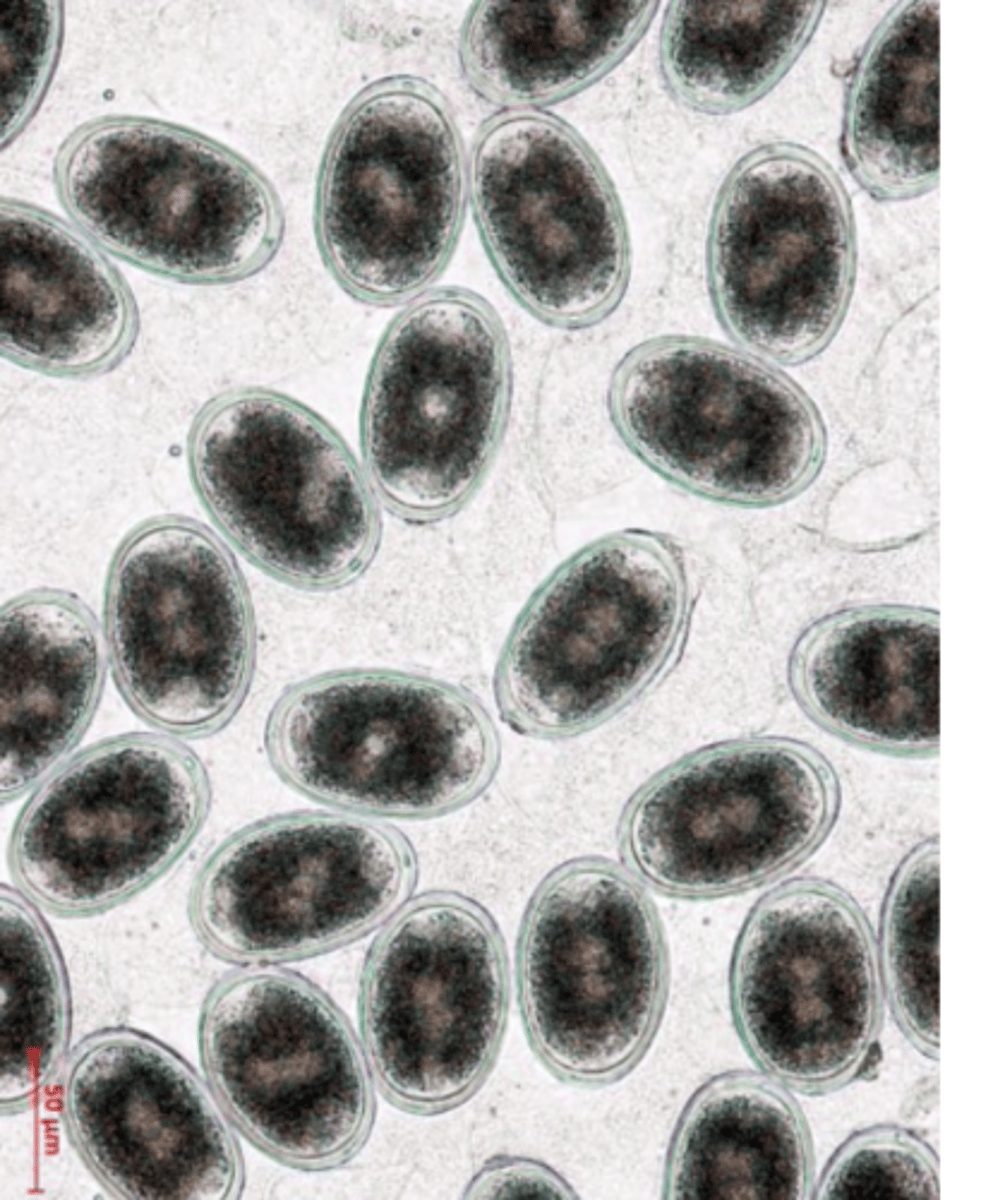 <p>History (age), clinical signs;</p><p>Visualization of eggs in the faeces</p><p>- Elipsoidal,</p><p>- Thick, smooth shell;</p><p>- One cell inside.</p><p>Eggs of Ascaridia galli are difficult to differentiate from eggs of Heterakis galinarum!</p>