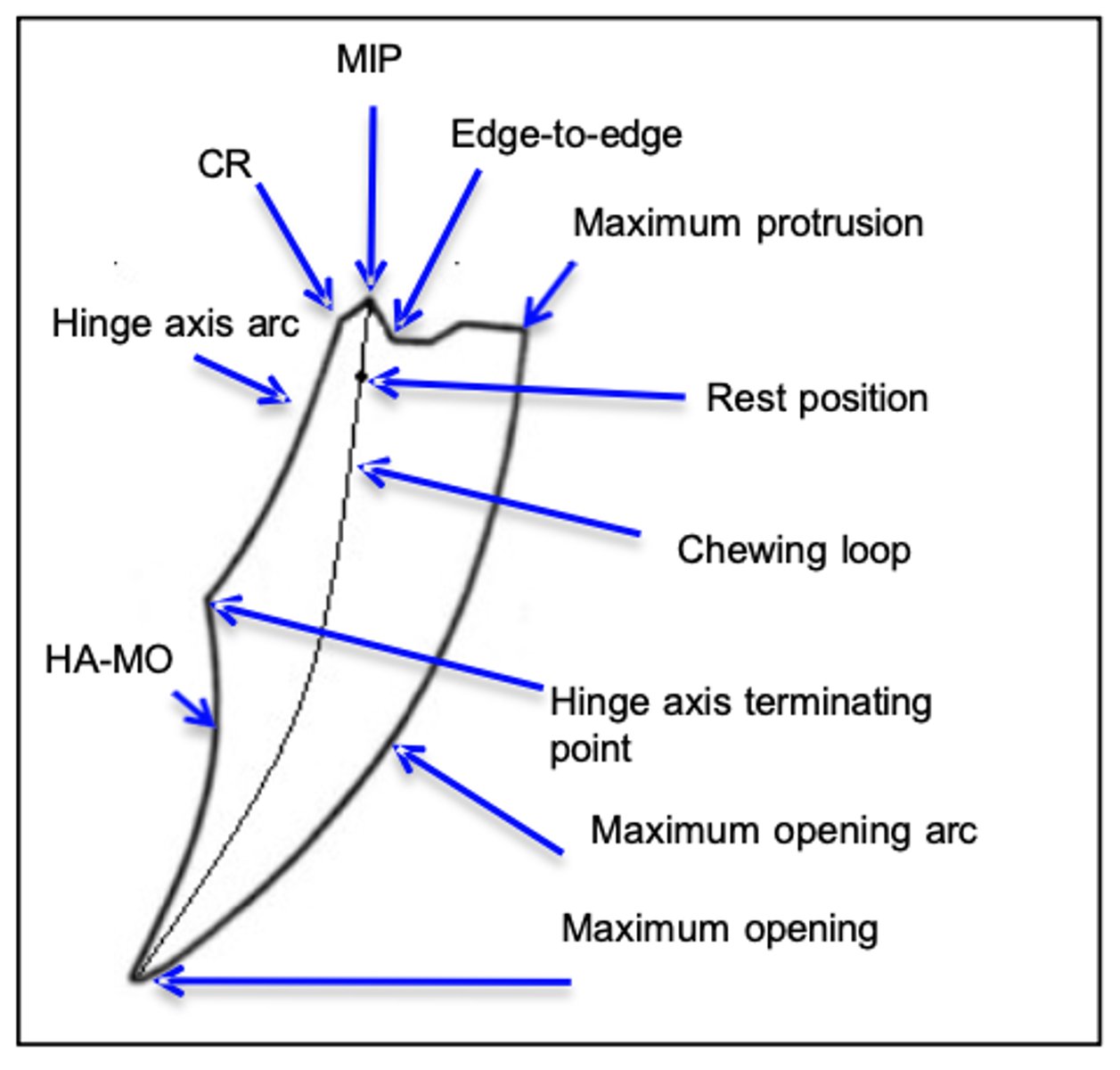 <p>This is a trajectory of how the mandible moves in what plane?</p>
