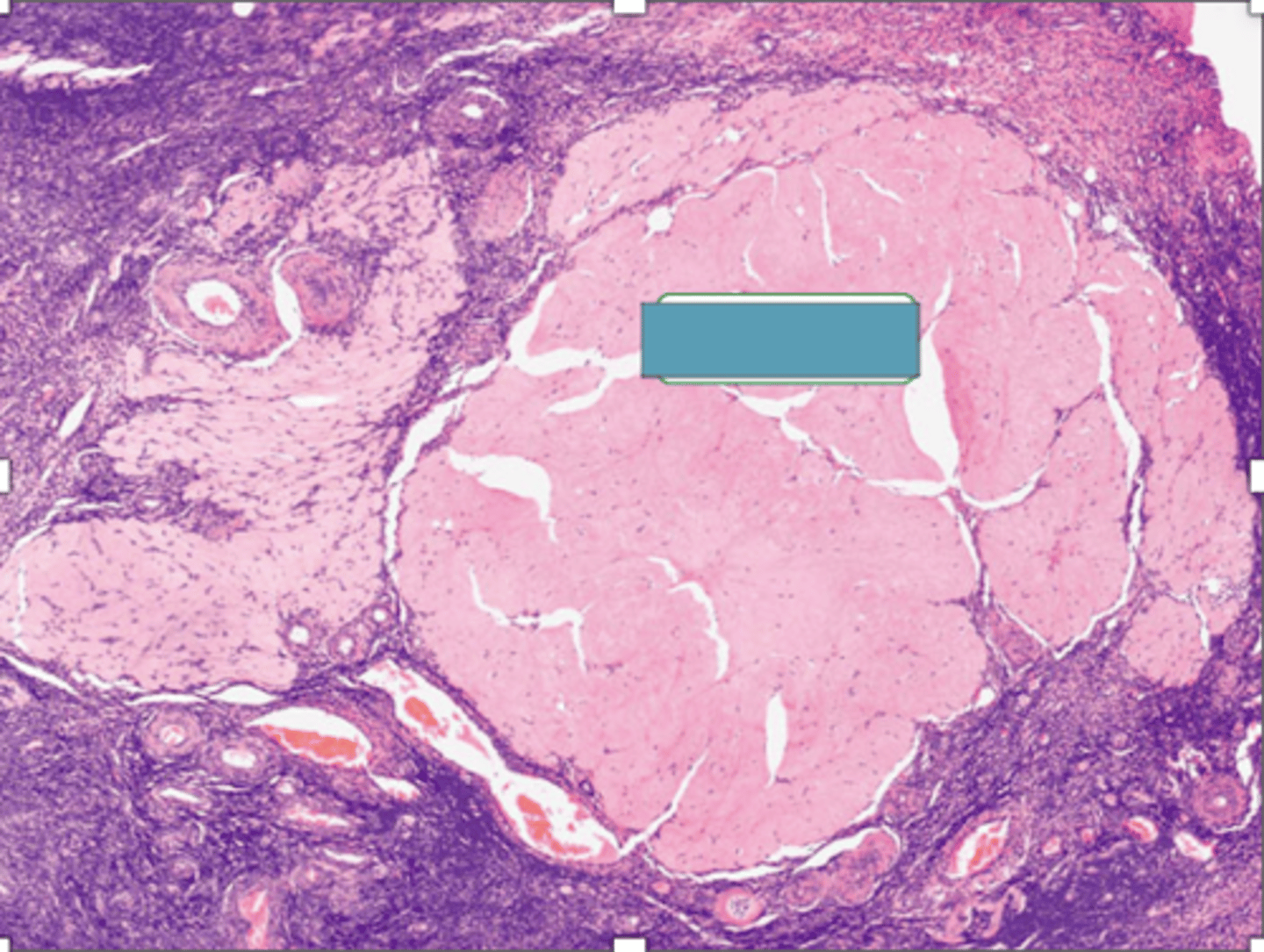 <p>identify the structure</p>