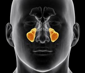 <p>What paranasal sinus is this? </p>