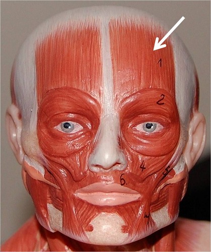 <p>muscle of the forehead that moves the forehead skin and eyebrows</p>