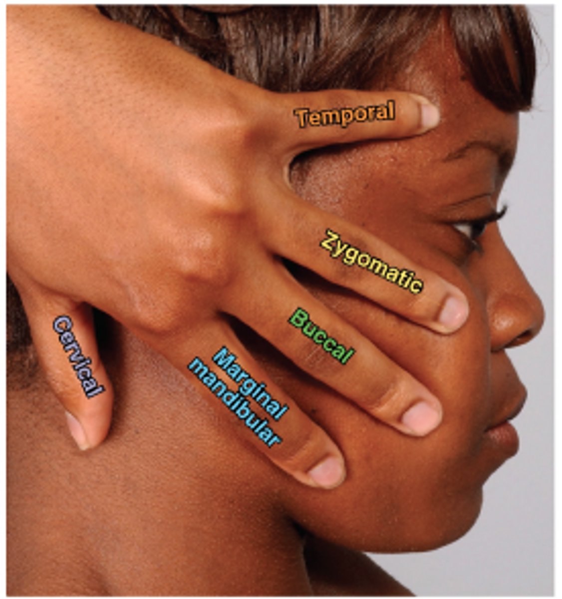 <p>Temporal</p><p>zygomatic</p><p>buccal</p><p>mandibular</p><p>cervical</p>