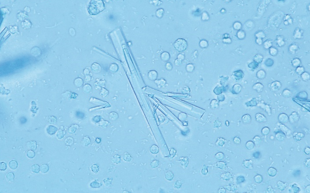 <p>Identify the urine sediment element shown:</p>