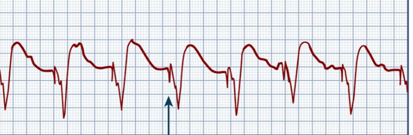 <p>What Rhythm is this?</p>