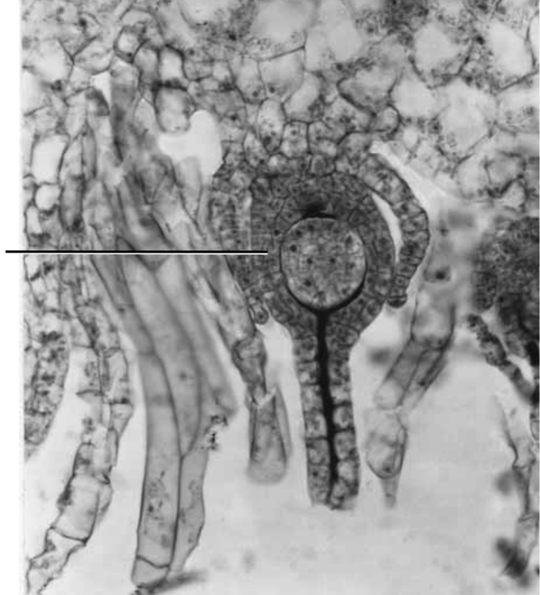 <p>Archegonium, which contains that egg and neck canal cells so the flagellated sperm swim through to reach the egg.</p>