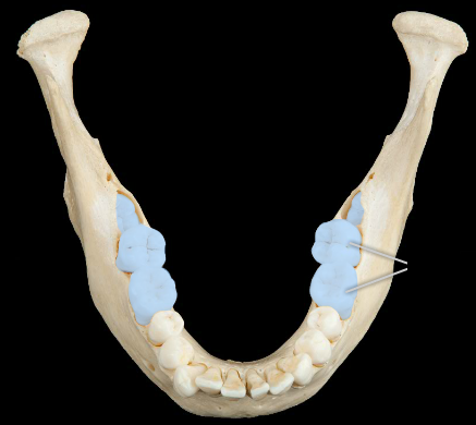 <p>molar</p>